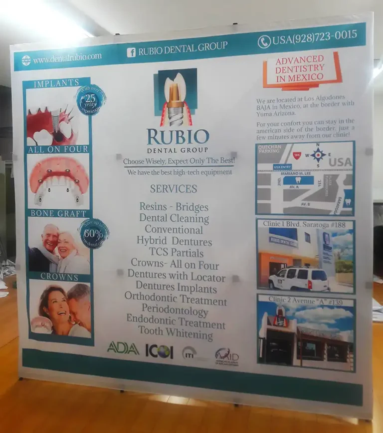 Displays y Banners Publicitarios en Tijuana Zotz Publicidad